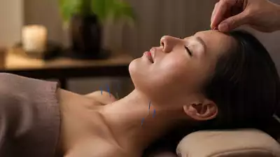 Akupunktur Therapie